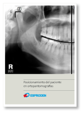 posicionamiento-ortopanto